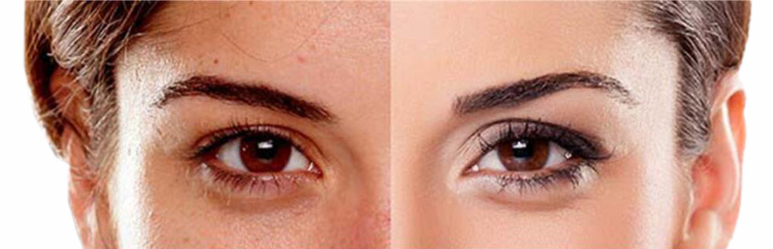 Cosmetics for Skin Pigmentation