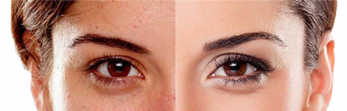 Cosmetics for Skin Pigmentation
